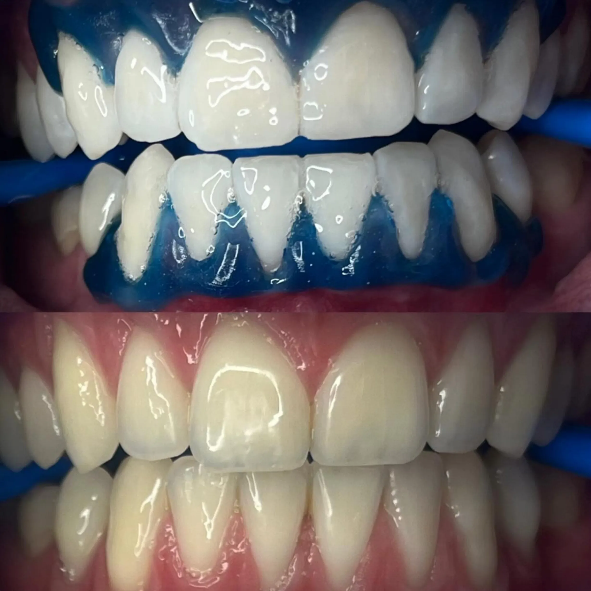 cosmetic teeth whitening course price